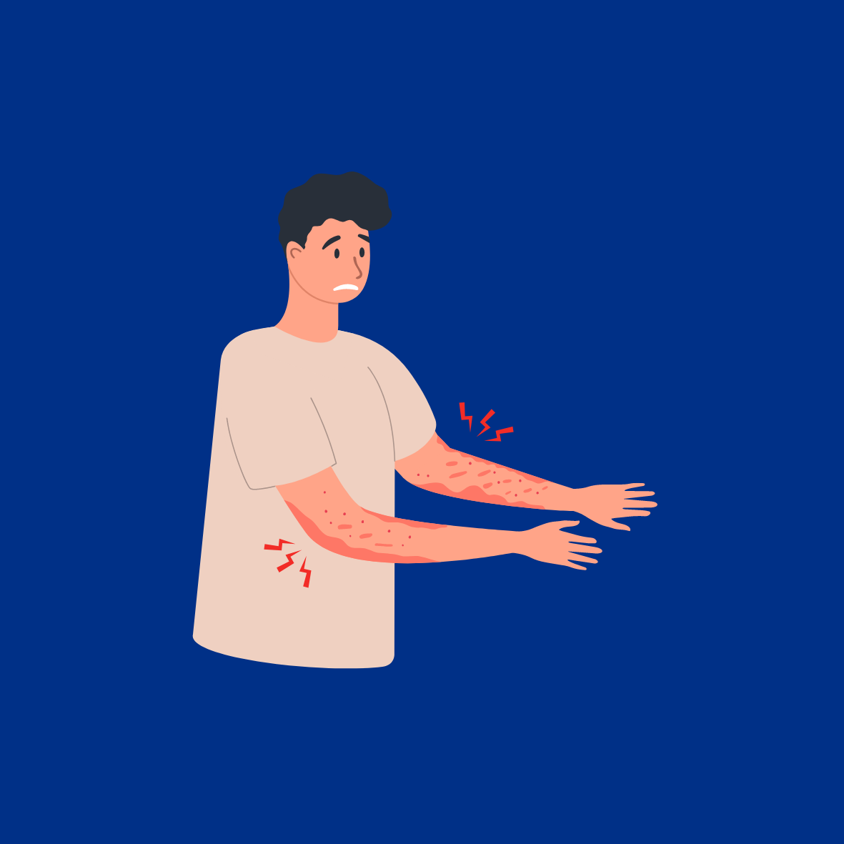 Image of Person With Skin Rash on Arms