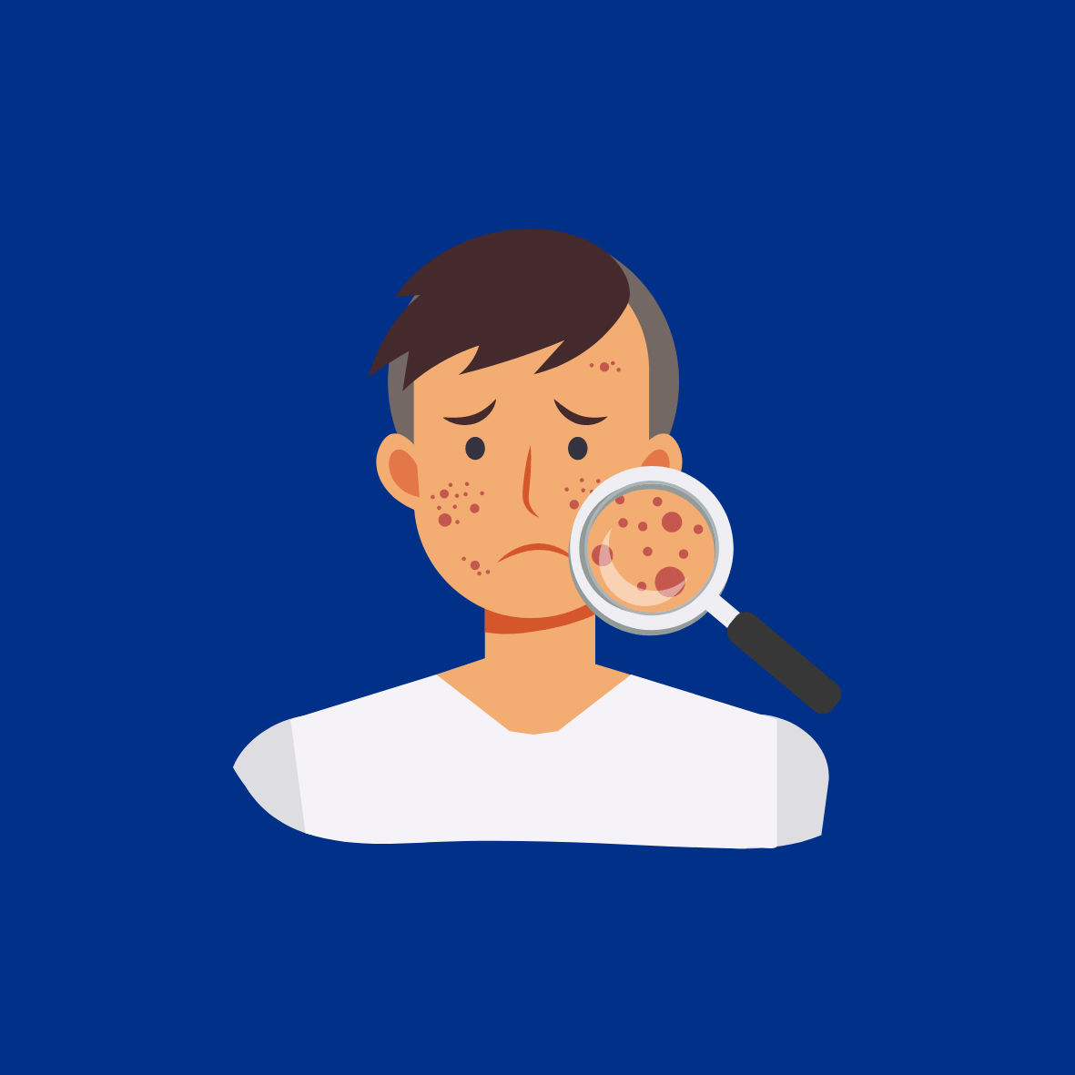 Image of Person With Acne