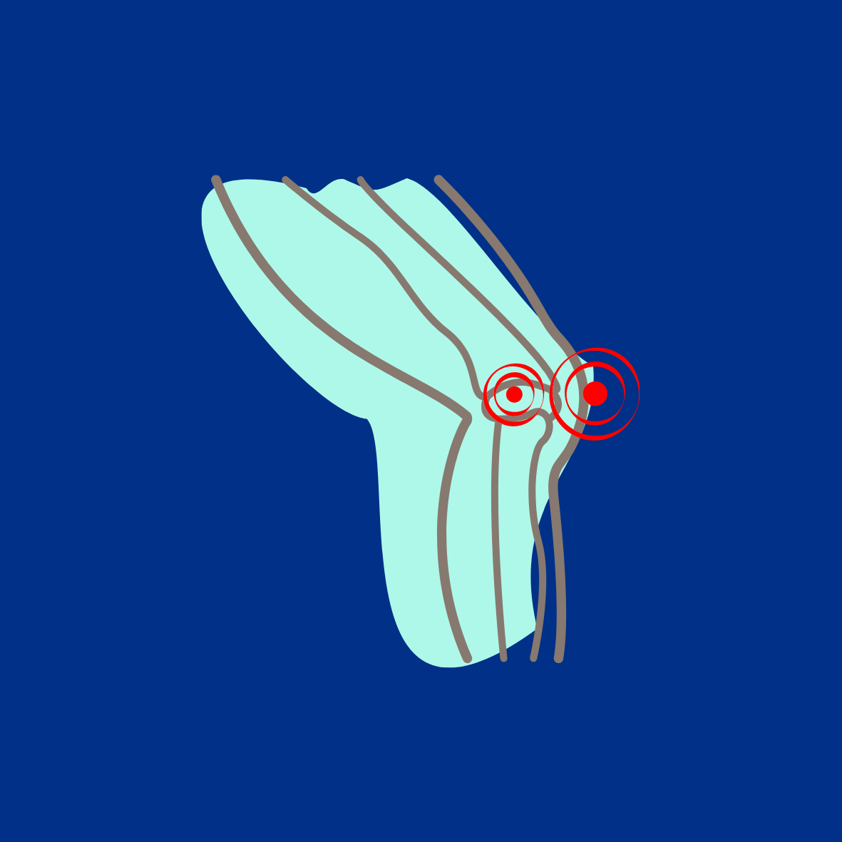 Image of Knee and Pain in The Joint to Represent Arthritis
